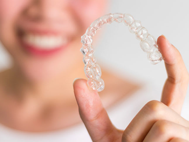 Pick Up Your Aligners